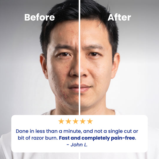 Before and after using the Face Shaver 2.0